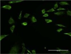 RPLP1 Antibody (1G10), Novus Biologicals 0.1 mg | Buy Online | Novus Biologicals | Fisher Scientific