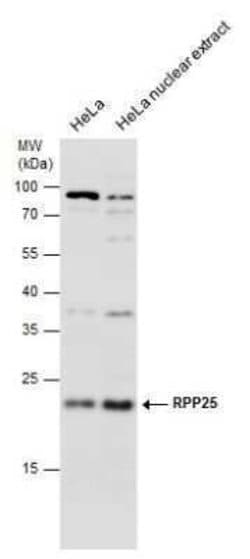 RPP25 Antibody, Novus Biologicals 100 &mu;g; Unconjugated:Antibodies, Polyclonal