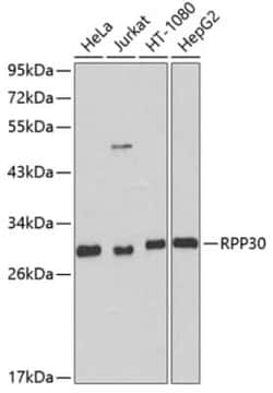 RPP30 Antibody - BSA Free, Novus Biologicals 0.02 mL | Buy Online | Novus Biologicals | Fisher Scientific