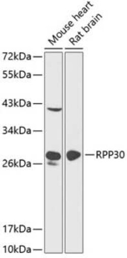 RPP30 Antibody - BSA Free, Novus Biologicals 0.1 mL; Unconjugated:Antibodies,