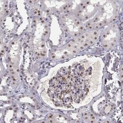 RPP38 Antibody, Novus Biologicals:Antibodies:Primary Antibodies