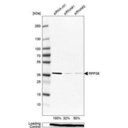 RPP38 Antibody, Novus Biologicals 25 &mu;L | Buy Online | Novus Biologicals | Fisher Scientific