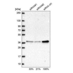 RPP38 Antibody, Novus Biologicals 25 &mu;L | Buy Online | Novus Biologicals | Fisher Scientific