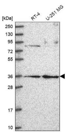 RPP38 Antibody, Novus Biologicals:Antibodies:Primary Antibodies
