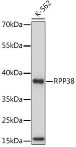 RPP38 Antibody - Azide and BSA Free, Novus Biologicals:Antibodies:Primary