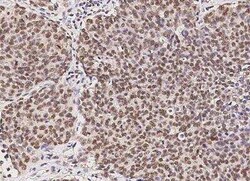 RPRD1B Antibody (08), Novus Biologicals 50 &mu;g | Buy Online | Novus Biologicals | Fisher Scientific