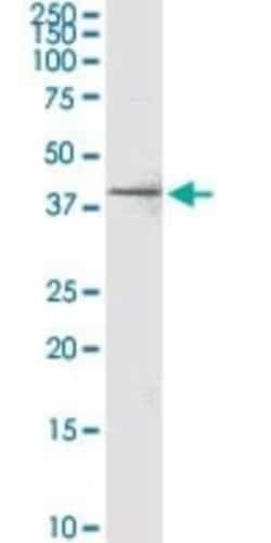 RPRD1B Antibody (4D6), Novus Biologicals 0.1 mg; Unconjugated:Antibodies,
