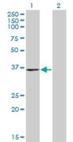 RPRD1B Antibody (4D6), Novus Biologicals 0.1 mg; Unconjugated:Antibodies,