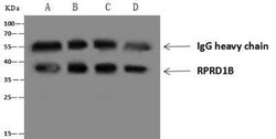 RPRD1B Antibody, Novus Biologicals:Antibodies:Primary Antibodies