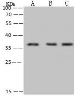 RPRD1B Antibody, Novus Biologicals:Antibodies:Primary Antibodies