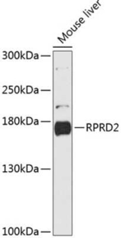RPRD2 Antibody - Azide and BSA Free, Novus Biologicals:Antibodies:Primary