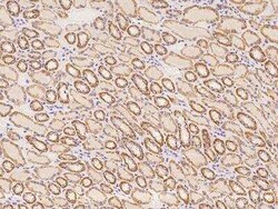 RPRML Antibody, Novus Biologicals 100 &mu;g; Unconjugated:Antibodies, Polyclonal