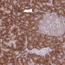 RPS10 Antibody, Novus Biologicals 25 &mu;L, Unconjugated:Antibodies, Polyclonal