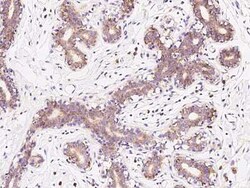 RPS10 Antibody, Novus Biologicals 50 &mu;g | Buy Online | Novus Biologicals | Fisher Scientific
