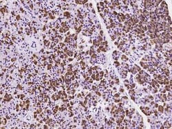 RPS10 Antibody, Novus Biologicals 50 &mu;g | Buy Online | Novus Biologicals | Fisher Scientific