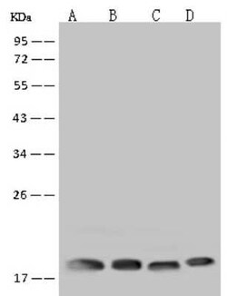RPS10 Antibody, Novus Biologicals 50 &mu;g | Buy Online | Novus Biologicals | Fisher Scientific