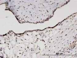 RPS11 Antibody (2A5), Novus Biologicals 0.1 mg | Buy Online | Novus Biologicals | Fisher Scientific