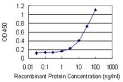 RPS11 Antibody (2A5), Novus Biologicals 0.1 mg | Buy Online | Novus Biologicals | Fisher Scientific