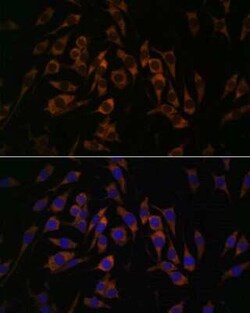 RPS13 Antibody - Azide and BSA Free, Novus Biologicals 0.02 mL; Unconjugated:Antibodies,
