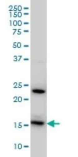 RPS17 Antibody (2C7), Novus Biologicals 50 &mu;g | Buy Online | Novus Biologicals | Fisher Scientific