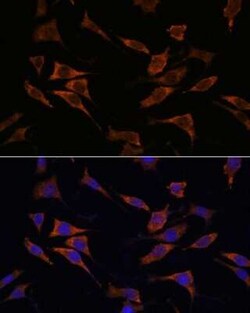RPS17 Antibody - Azide and BSA Free, Novus Biologicals:Antibodies:Primary