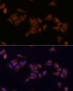 RPS17 Antibody - Azide and BSA Free, Novus Biologicals:Antibodies:Primary