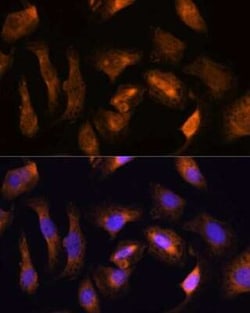 RPS17 Antibody - Azide and BSA Free, Novus Biologicals:Antibodies:Primary