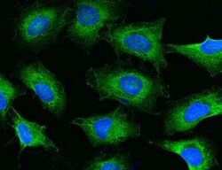 RPS17 Antibody, Novus Biologicals 100 &mu;g; Unconjugated:Antibodies, Polyclonal
