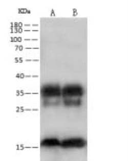 RPS17 Antibody, Novus Biologicals 100 &mu;g; Unconjugated:Antibodies, Polyclonal