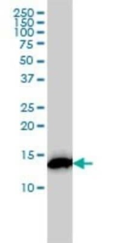 RPS19 Antibody (3C6), Novus Biologicals 0.1 mg | Buy Online | Novus Biologicals | Fisher Scientific
