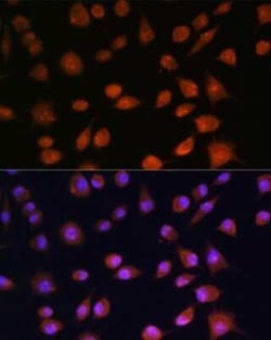 RPS19BP1 Antibody - Azide and BSA Free, Novus Biologicals 0.1 mL, Unconjugated:Antibodies,