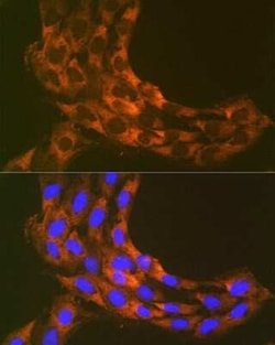RPS20 Rabbit anti-Human, Mouse, Rat, Clone: 9H1D4, Novus Biologicals 20