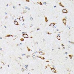 RPS20 Rabbit anti-Human, Mouse, Rat, Clone: 9H1D4, Novus Biologicals 20