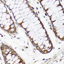 RPS20 Rabbit anti-Human, Mouse, Rat, Clone: 9H1D4, Novus Biologicals 20