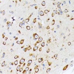 RPS20 Rabbit anti-Human, Mouse, Rat, Clone: 9H1D4, Novus Biologicals 20