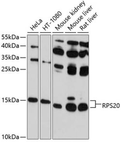 RPS20 Antibody - BSA Free, Novus Biologicals 0.1 mL; Unconjugated:Antibodies,