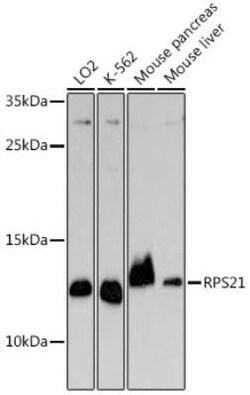 RPS21 Rabbit anti-Human, Mouse, Polyclonal, Novus Biologicals 100 &mu;g;