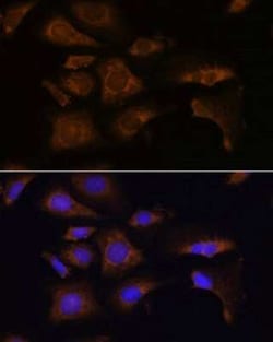 RPS25 Antibody - Azide and BSA Free, Novus Biologicals:Antibodies:Primary