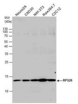 RPS26 Antibody, Novus Biologicals 100 &mu;g; Unconjugated:Antibodies, Polyclonal