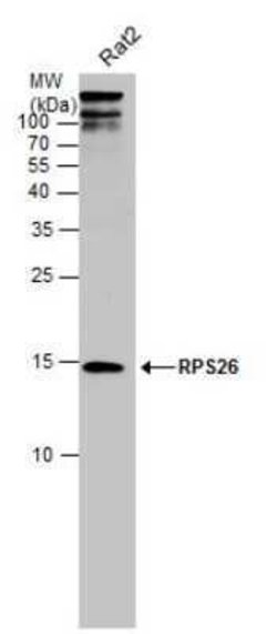 RPS26 Antibody, Novus Biologicals 100 &mu;g; Unconjugated:Antibodies, Polyclonal