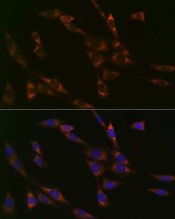 RPS3 Rabbit anti-Human, Mouse, Rat, Clone: 3X2M4, Novus Biologicals:Antibodies:Primary