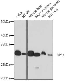 RPS3 Rabbit anti-Human, Mouse, Rat, Clone: 3X2M4, Novus Biologicals:Antibodies:Primary