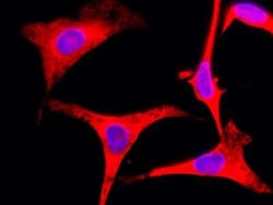 RPS3 Antibody, Novus Biologicals 100 &mu;g, Unconjugated:Antibodies, Polyclonal