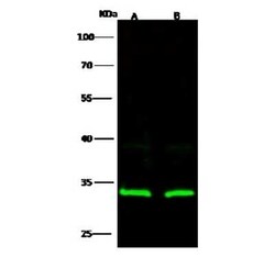 RPS3 Antibody, Novus Biologicals 100 &mu;g, Unconjugated:Antibodies, Polyclonal