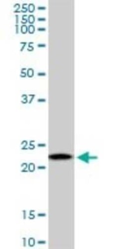 RPS5 Antibody (3G3), Novus Biologicals 0.1 mg | Buy Online | Novus Biologicals | Fisher Scientific