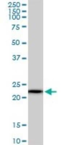 RPS5 Antibody (3G3), Novus Biologicals 0.1 mg | Buy Online | Novus Biologicals | Fisher Scientific