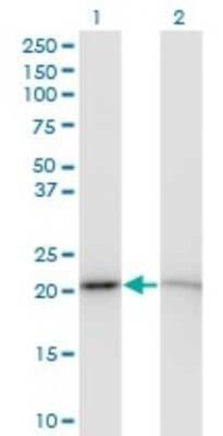 RPS5 Antibody (3G3), Novus Biologicals 0.1 mg | Buy Online | Novus Biologicals | Fisher Scientific