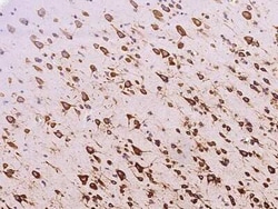 RPS5 Antibody, Novus Biologicals 100 &mu;g, Unconjugated:Anticuerpos
