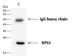 RPS5 Antibody, Novus Biologicals 100 &mu;g, Unconjugated:Anticuerpos