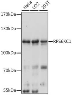 RPS6KC1 Antibody - Azide and BSA Free, Novus Biologicals:Antibodies:Primary